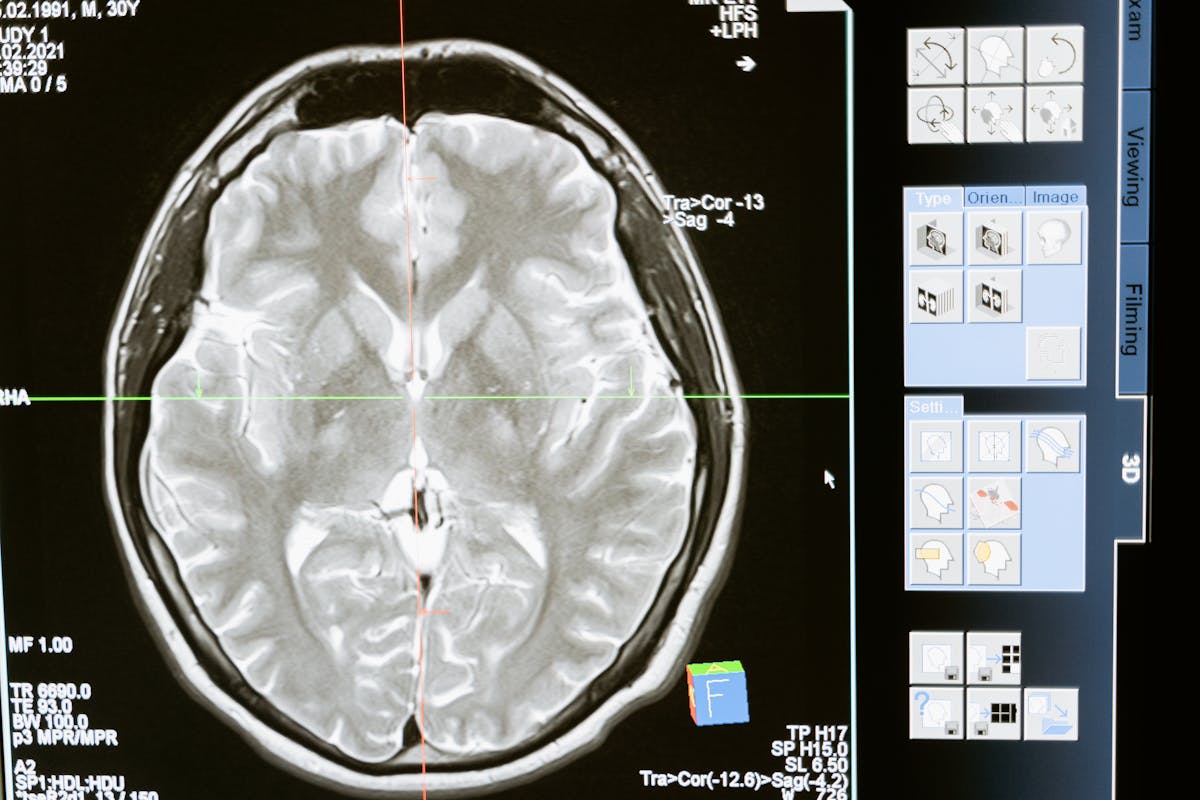 Article 02 Default Mode Network